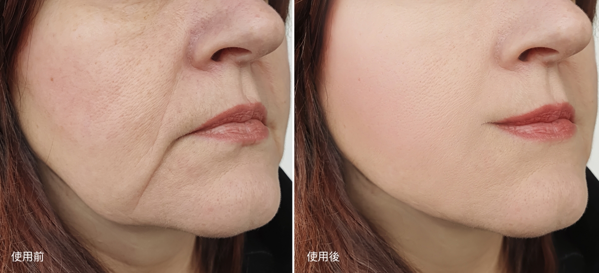 【讀者限定】無需打針！教你簡單步驟擁有逆齡彈滑水感肌